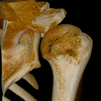 CT-DVT - 7G - Multi-Scan-Body - Beispielbild 2 - Professor Citak Gesundheitszentrum - Orthopädie - Hamburg