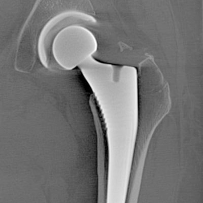 CT-DVT - 7G - Multi-Scan-Body - Beispielbild 3 - Professor Citak Gesundheitszentrum - Orthopädie - Hamburg